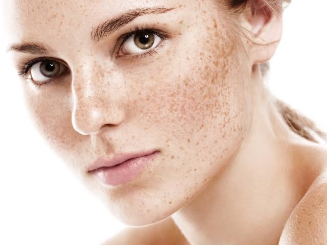 Learn why your skin is more Pigmentation and how to treat it