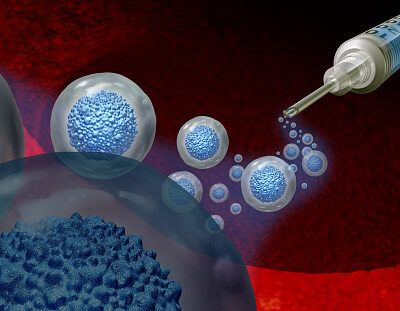 stem cell treatment